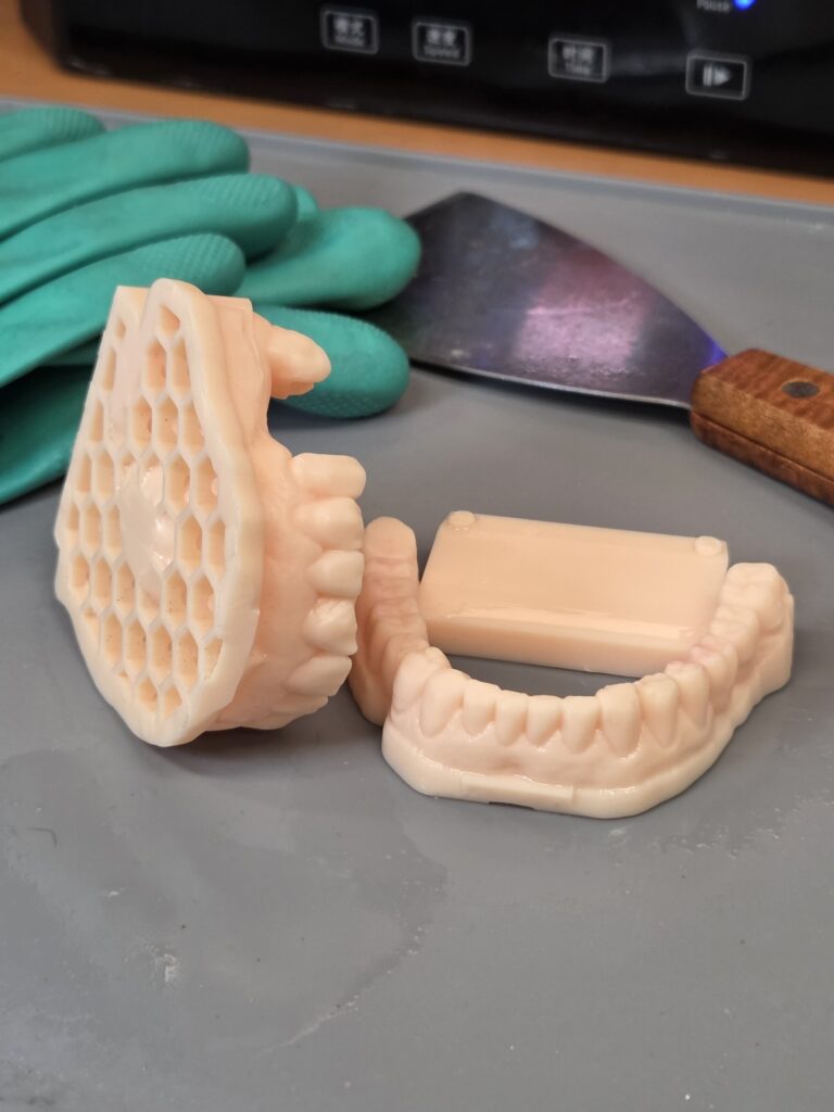 Impression 3D résine SLA prothèse dentaire